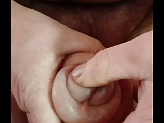 Saline balls and pumped at hand cock&period;